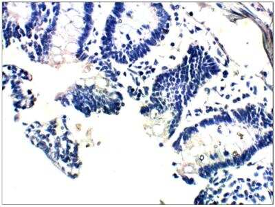 Immunohistochemistry-Paraffin: VKORC1 Antibody [NBP3-12232]