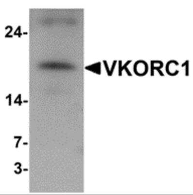 Western Blot: VKORC1 AntibodyBSA Free [NBP2-81859]