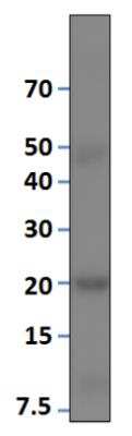 Western Blot: VKORC1 Antibody [NBP3-12232]