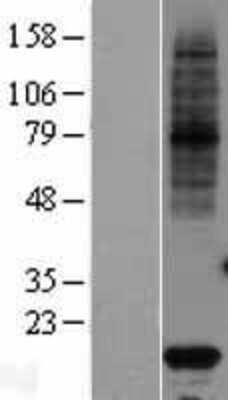 Western Blot: VKORC1 Overexpression Lysate [NBL1-17727]