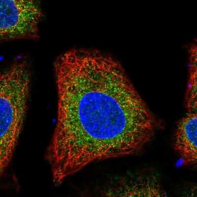 Immunocytochemistry/ Immunofluorescence: VKORC1L1 Antibody [NBP2-13516]