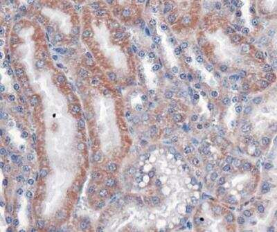 Immunohistochemistry: VLDLR Antibody (6A6) - BSA Free [NBP1-78162]