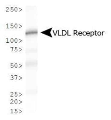 Western Blot: VLDLR Antibody (6A6)BSA Free [NBP1-78162]