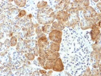 Immunohistochemistry-Paraffin: VLDLR Antibody (VLDLR/1337) - Azide and BSA Free [NBP2-54553]