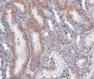 Immunohistochemistry: VLDLR Antibody (6A6) - Azide and BSA Free [NBP2-81010]