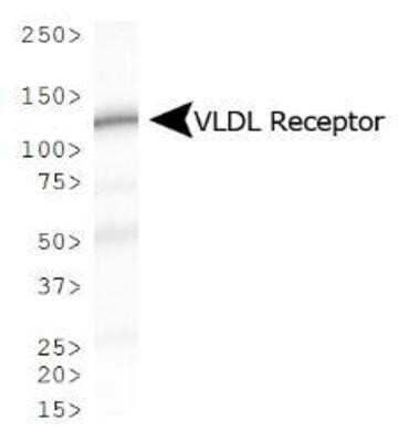 Western Blot: VLDLR Antibody (6A6)Azide and BSA Free [NBP2-81010]