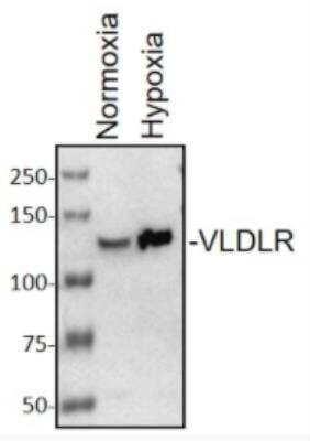 Western Blot: VLDLR Antibody (6A6)BSA Free [NBP1-78162]