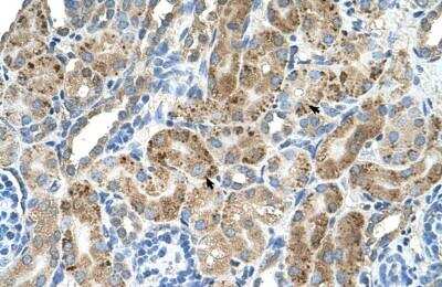 Immunohistochemistry-Paraffin: VMA21 Antibody [NBP1-59918]