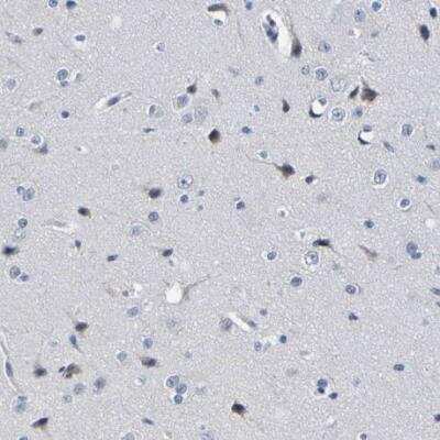 Immunohistochemistry-Paraffin: VMA21 Antibody [NBP1-82783]