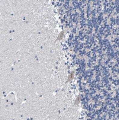 Immunohistochemistry-Paraffin: VMA21 Antibody [NBP1-82783]