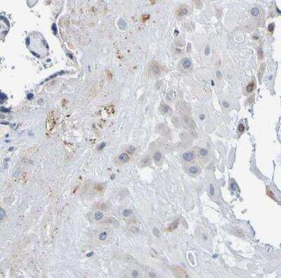 Immunohistochemistry-Paraffin: VMA21 Antibody [NBP1-82783]