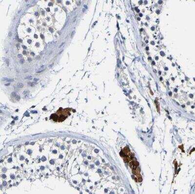 Immunohistochemistry-Paraffin: VMA21 Antibody [NBP1-82783]