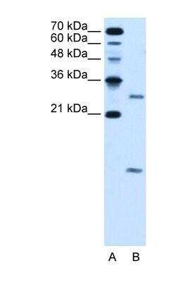 Western Blot: VMA21 Antibody [NBP1-59918]