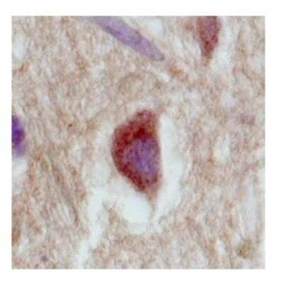 Immunohistochemistry: VMAT1/SLC18A1 Antibody [NBP2-88577]