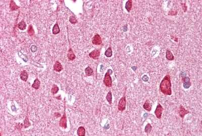 Immunohistochemistry: VMAT1/SLC18A1 Antibody [NBP2-88577]