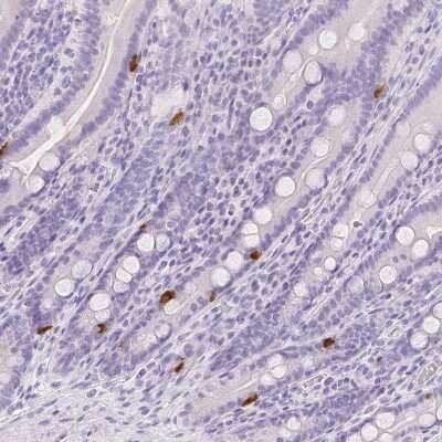 Immunohistochemistry-Paraffin: VMAT1/SLC18A1 Antibody [NBP2-55798]