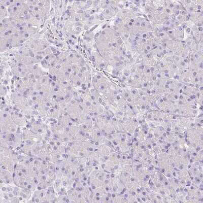 Immunohistochemistry-Paraffin: VMAT1/SLC18A1 Antibody [NBP2-55798]