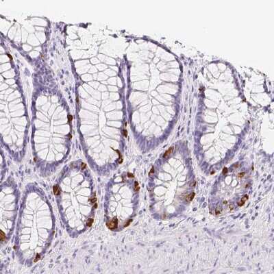 Immunohistochemistry-Paraffin: VMAT1/SLC18A1 Antibody [NBP2-55798]