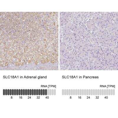 Immunohistochemistry-Paraffin: VMAT1/SLC18A1 Antibody [NBP2-55798]