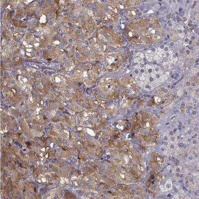 Immunohistochemistry-Paraffin: VMAT1/SLC18A1 Antibody [NBP2-58895]
