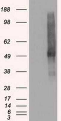 Western Blot: VMAT2 Antibody (OTI9E11) [NBP1-47977]