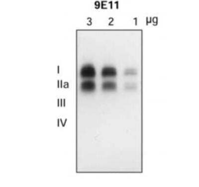 Western Blot: VMAT2 Antibody (OTI9E11) [NBP1-47977]