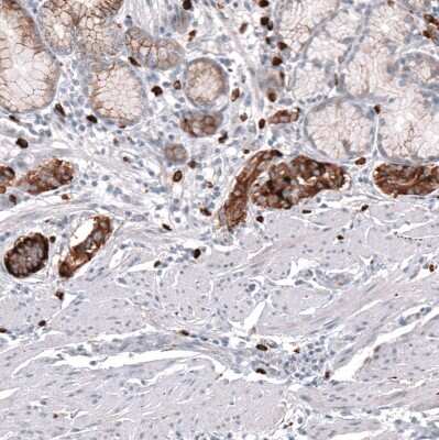Immunohistochemistry-Paraffin: VMAT2 Antibody (CL12531) [NBP3-18570]