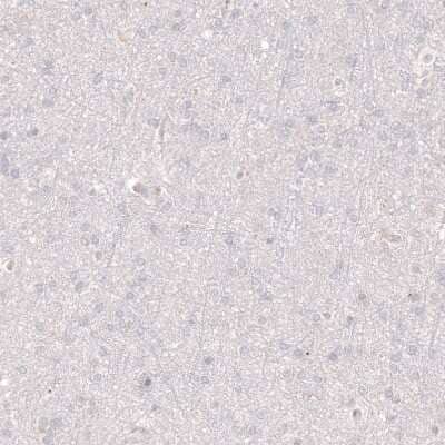 Immunohistochemistry-Paraffin: VMAT2 Antibody (CL12531) [NBP3-18570]