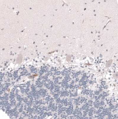 Immunohistochemistry-Paraffin: VMAT2 Antibody (CL12531) [NBP3-18570]