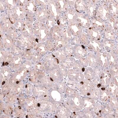Immunohistochemistry-Paraffin: VMAT2 Antibody (CL13157) [NBP3-18556]