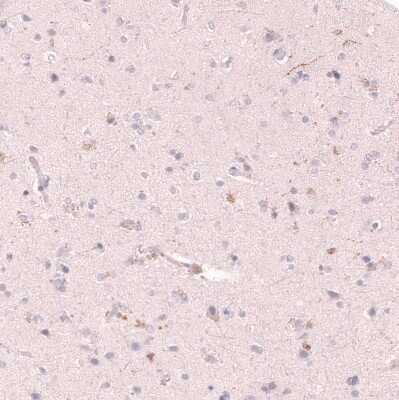 Immunohistochemistry-Paraffin: VMAT2 Antibody (CL13157) [NBP3-18556]