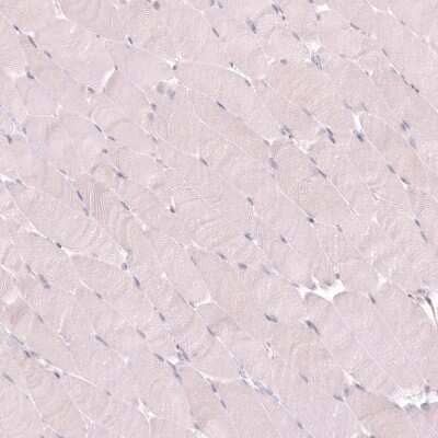Immunohistochemistry-Paraffin: VMAT2 Antibody (CL13157) [NBP3-18556]