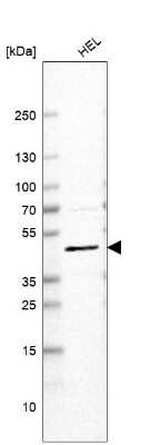 Western Blot: VMAT2 Antibody (CL13157) [NBP3-18556]