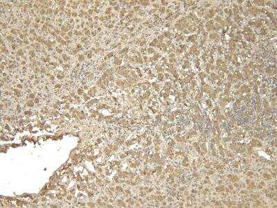 Immunohistochemistry: VMAT2 Antibody [NB100-1479]