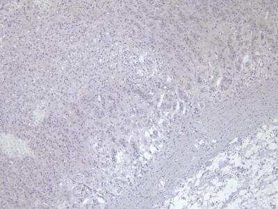 Immunohistochemistry: VMAT2 Antibody [NB100-1479]