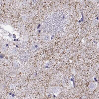 Immunohistochemistry: VMAT2 Antibody [NBP2-68952]