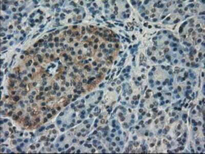 Immunohistochemistry: VMAT2 Antibody (OTI9E11) - Azide and BSA Free [NBP2-74850]