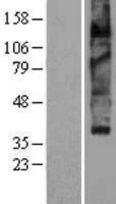 Western Blot: VMAT2 Overexpression Lysate [NBP2-04241]