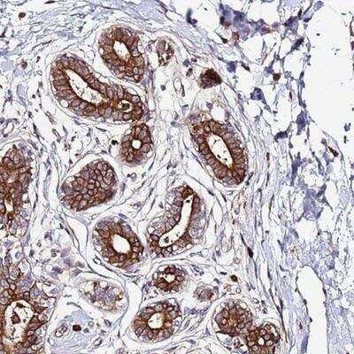 Immunohistochemistry-Paraffin: VMO1 Antibody [NBP1-92574]