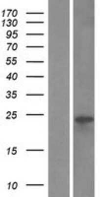 Western Blot: VMO1 Overexpression Lysate [NBL1-17730]