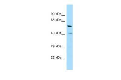 Western Blot: VN1R1 Antibody [NBP3-09465]