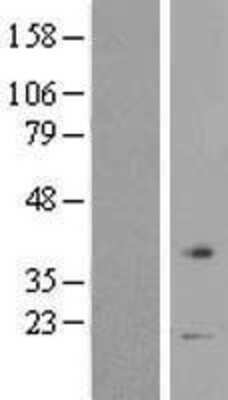 Western Blot: VN1R1 Overexpression Lysate [NBP2-06634]