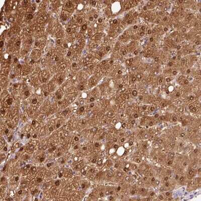 Immunohistochemistry: VN1R2 Antibody [NBP2-48814]