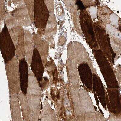 Immunohistochemistry-Paraffin: VN1R4 Antibody [NBP1-86869]