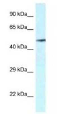 Western Blot: VNN2 Antibody [NBP1-79906]