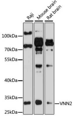 Western Blot: VNN2 AntibodyBSA Free [NBP2-93907]