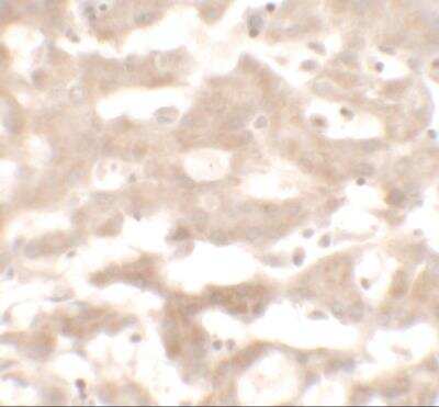 Immunohistochemistry: VNN3 Antibody - BSA Free [NBP2-81875]