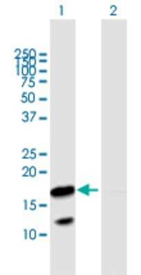 Western Blot: VNN3 Antibody [H00055350-B01P]