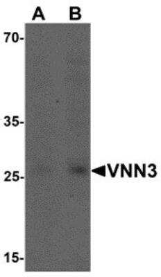 Western Blot: VNN3 AntibodyBSA Free [NBP2-81875]