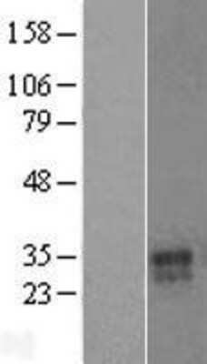 Western Blot: VNN3 Overexpression Lysate [NBL1-17733]